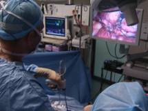 Description : Description : http://www.reseau-chu.org/fileadmin/reseau-chu/docs/2674/coelioscopie_ablation_rein.jpg